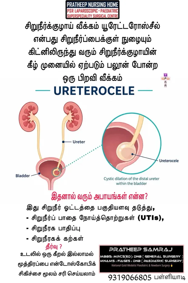 Operative photograph from ureterocele surgery