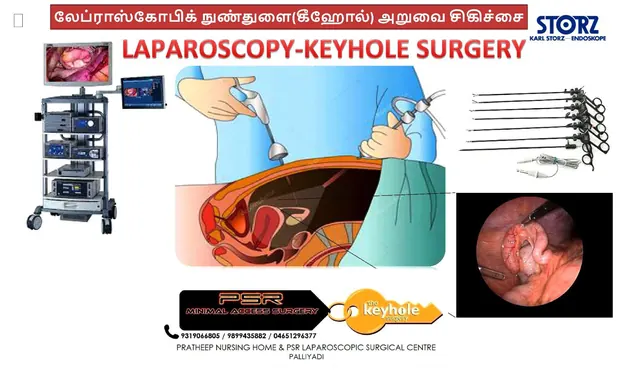 Illustrated chart explaining laparoscopic keyhole surgery in Tamil and English