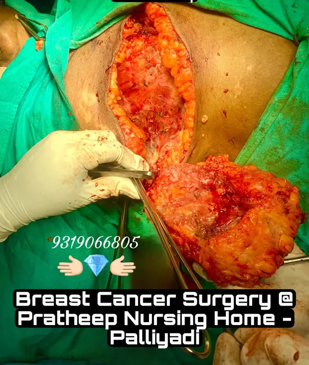 Operative photograph from breast cancer surgery