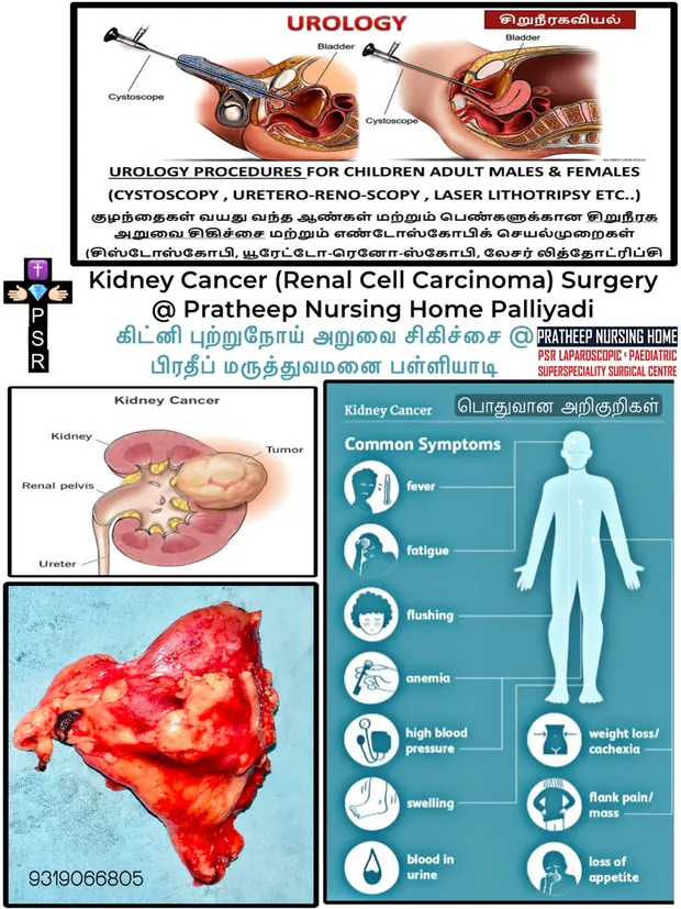 Operative photograph from kidney cancer surgery