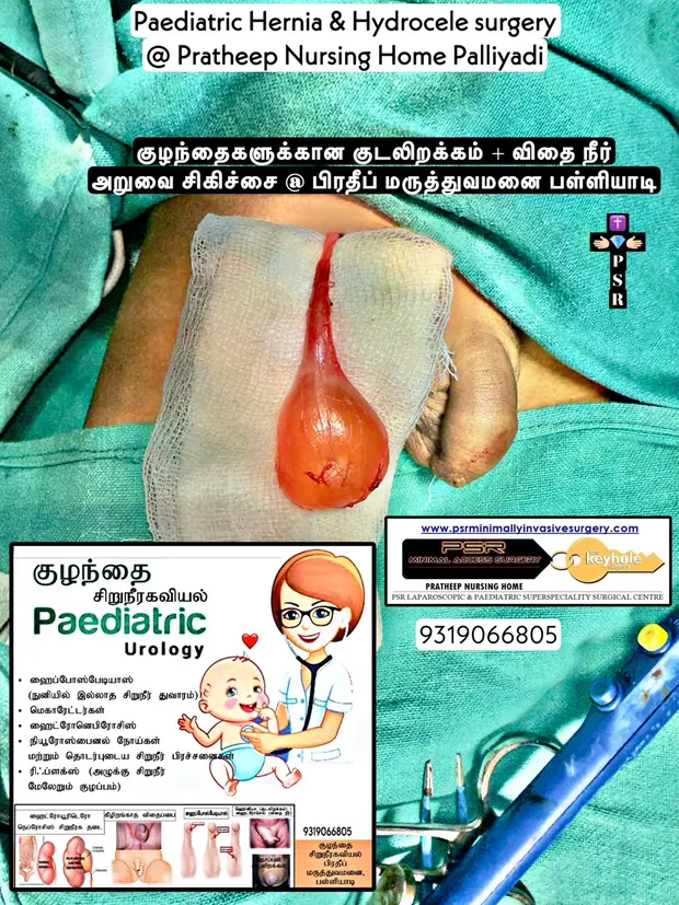 Operative photograph from paediatric hernia and hydrocele surgery with a paediatric urology chart