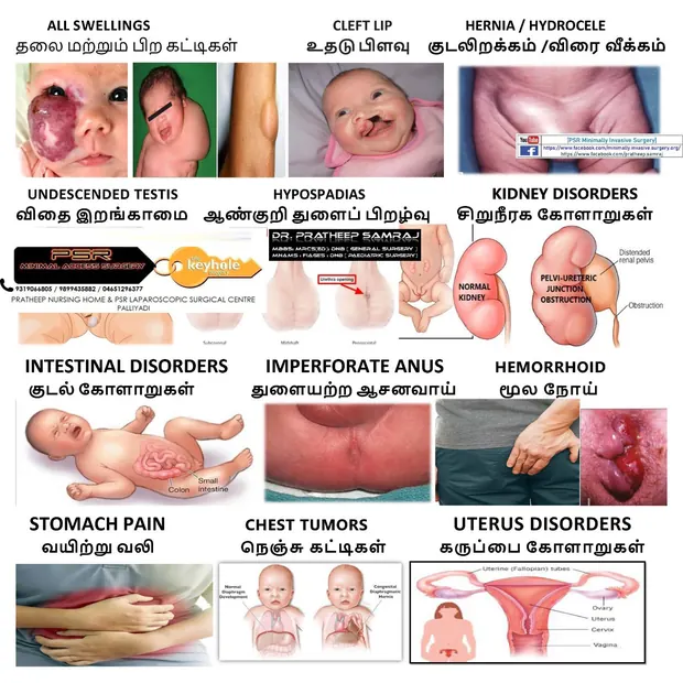 Hospital chart showing paediatric conditions including swellings, cleft lip, hernia and kidney disorders